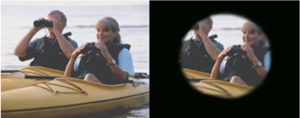 Glaucoma NJ