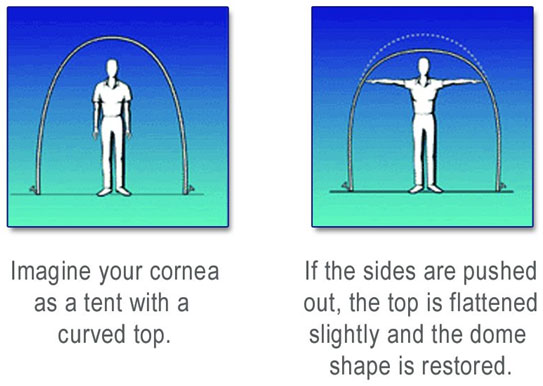 Cornea diagram | Freehold Ophthalmology Physicians & Surgeons New Jersey 